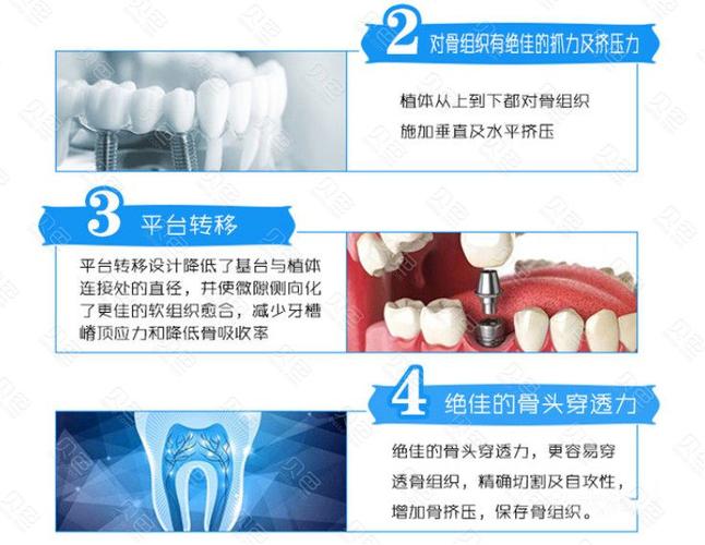 如何查询进口种植体信息（进口种植体是在国内生产的吗）