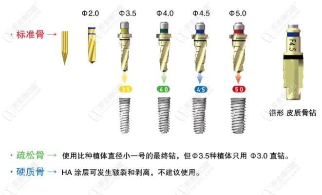 如何查询进口种植体信息（进口种植体是在国内生产的吗）