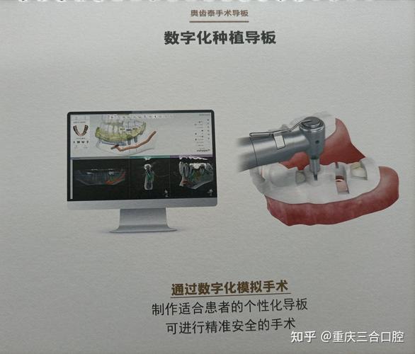 数字化种植牙信息采集-种植牙数字化取模